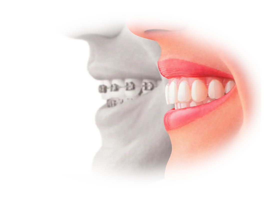 Smile-with-Confidence-A-Guide-to-Cosmetic-Dentistry